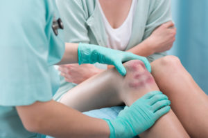 Cropped picture of a doctor examining bruises on a patient's knee at a 24 hour emergency room